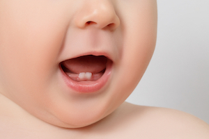 are baby teeth signs of expensive orthodontic treatment