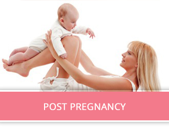 post pregnancy