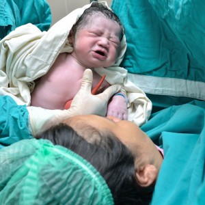 New born infant, cesarean, 