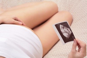 pregnant woman and ultrasound pictures