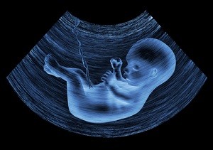 baby small on ultrasound