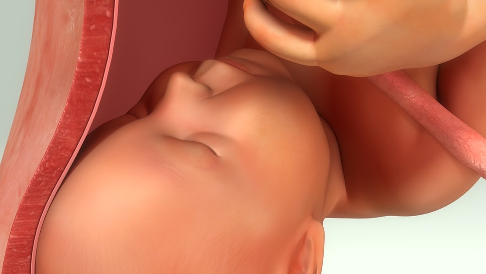 Anterior Placenta