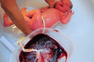 Placenta chronicles - 5 ideas for using your placenta
